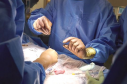 Surgeons successfully transplanted a pig kidney into a human for the first time