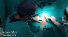 Laser hemorrhoid surgery. The latest method.